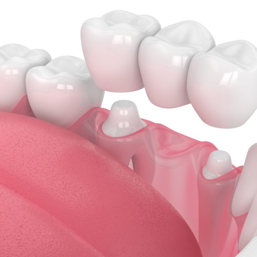 dental clinic in north delhi
