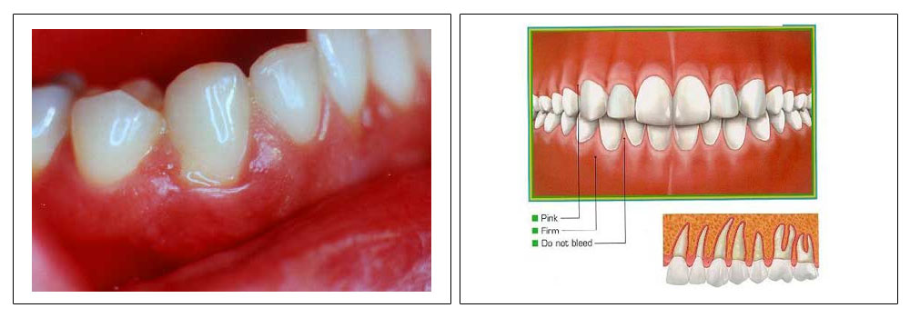 dental treatment in delhi