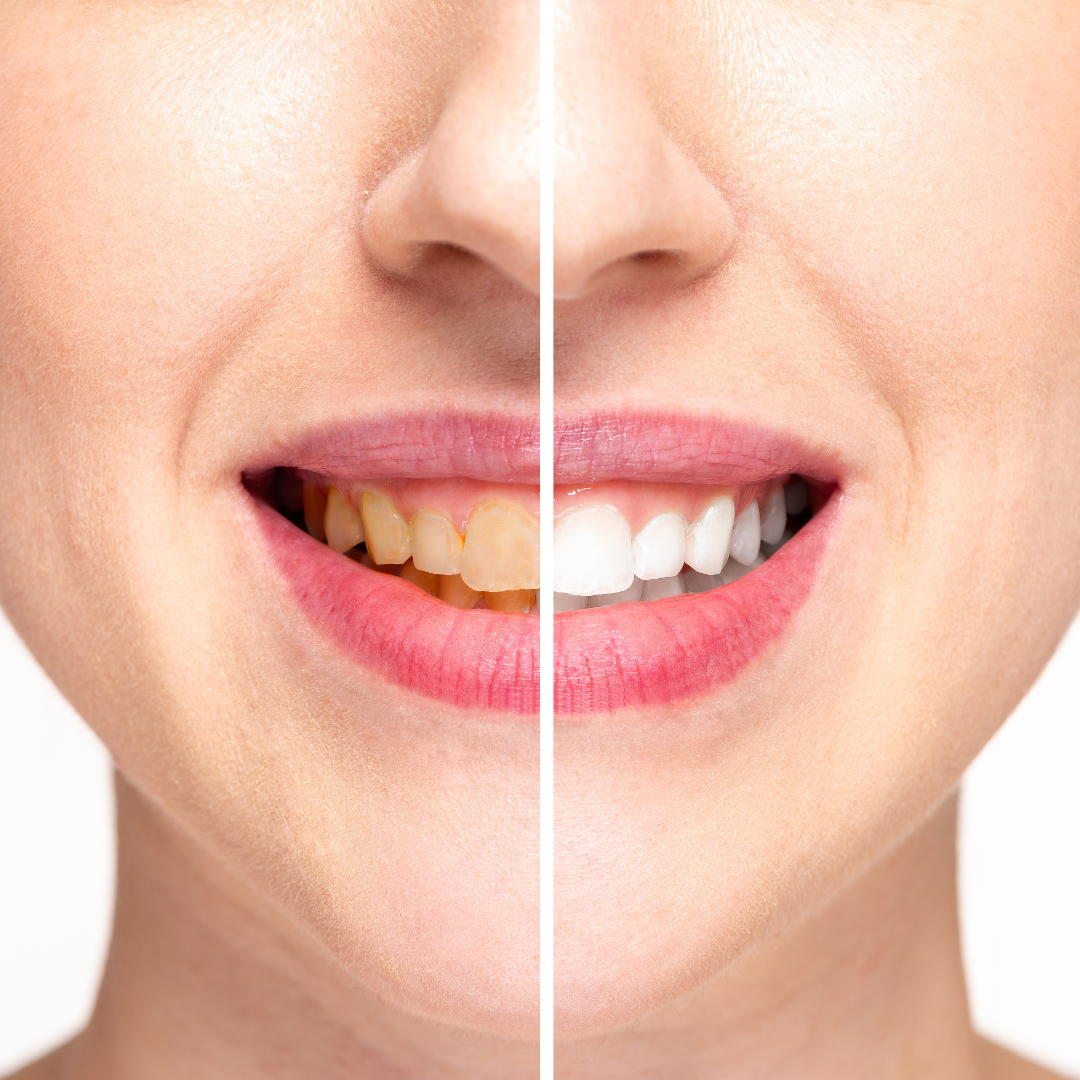 dental clinic shalimar bagh